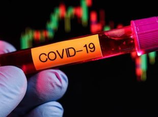 ACIJS incentiva empresas associadas na compra de testes rápidos do Covid-19 como forma de ampliar a prevenção